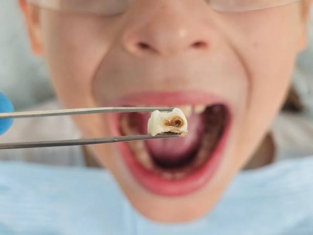 Best Cracked Tooth Emergency Dentist  in Vernon Valley, NJ